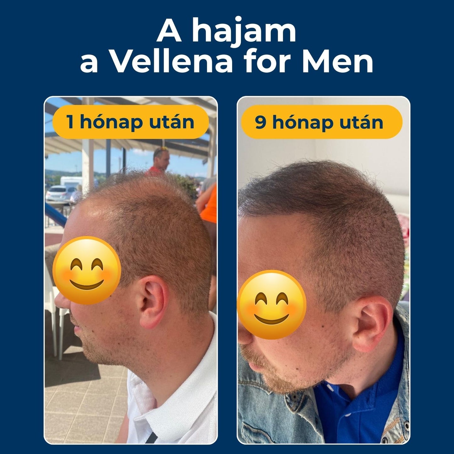 Férfi egészség | Kapszulák 3 PACK | Vellena for Men