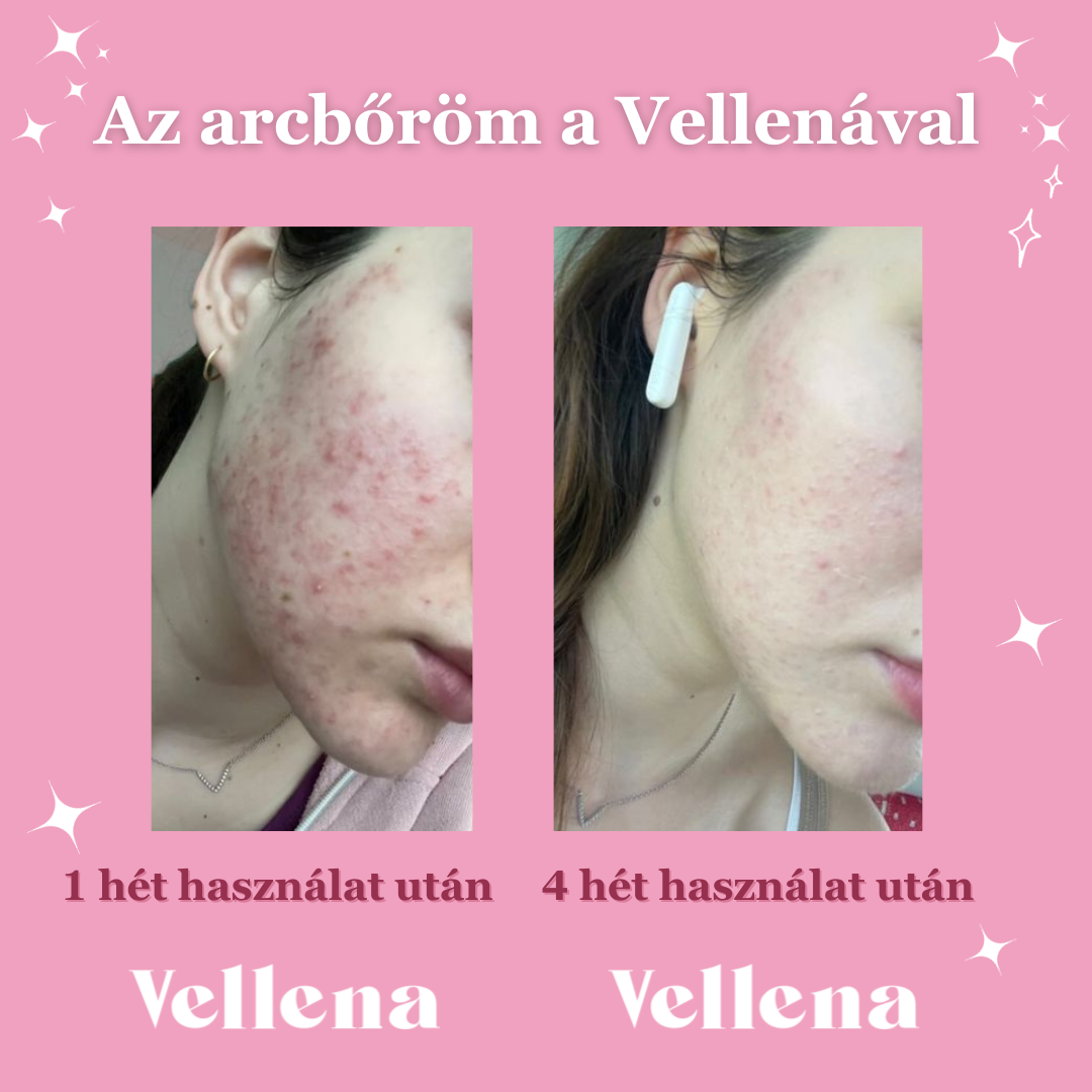 Női Egészség | Ital 3 PACK + INGYENES kanál | Alma Fahéj | Vellena