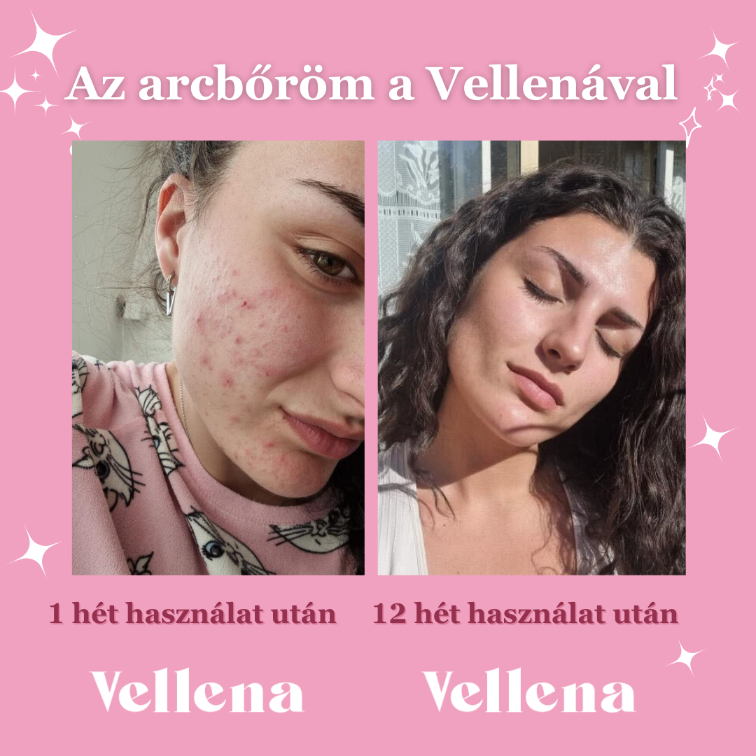 Női Egészség | Ital | Alma Fahéj | Vellena