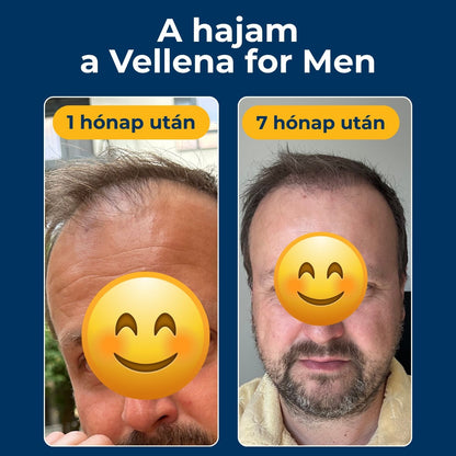 Férfi egészség | Kapszulák 3 PACK | Vellena for Men