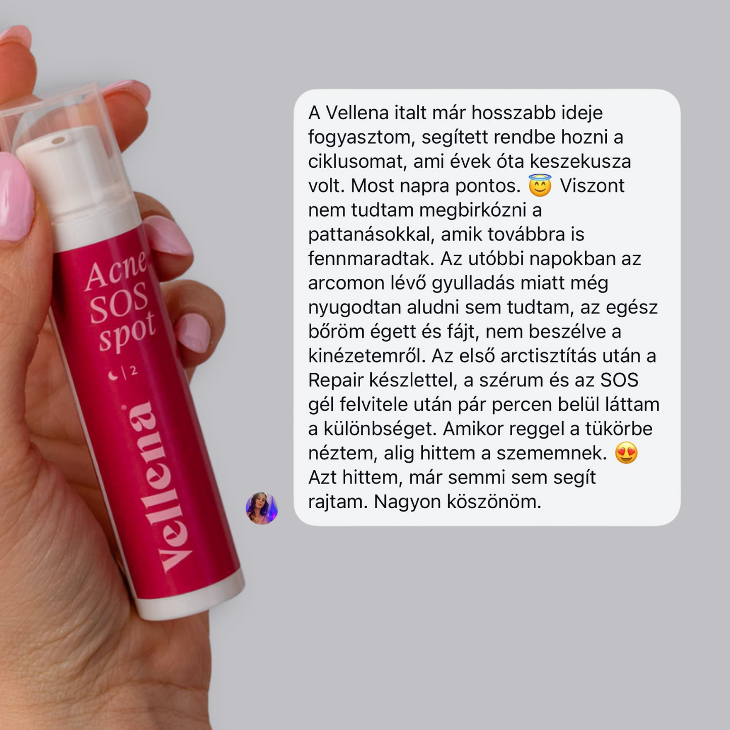Pattanáskezelő Gél 15ml | Vellena